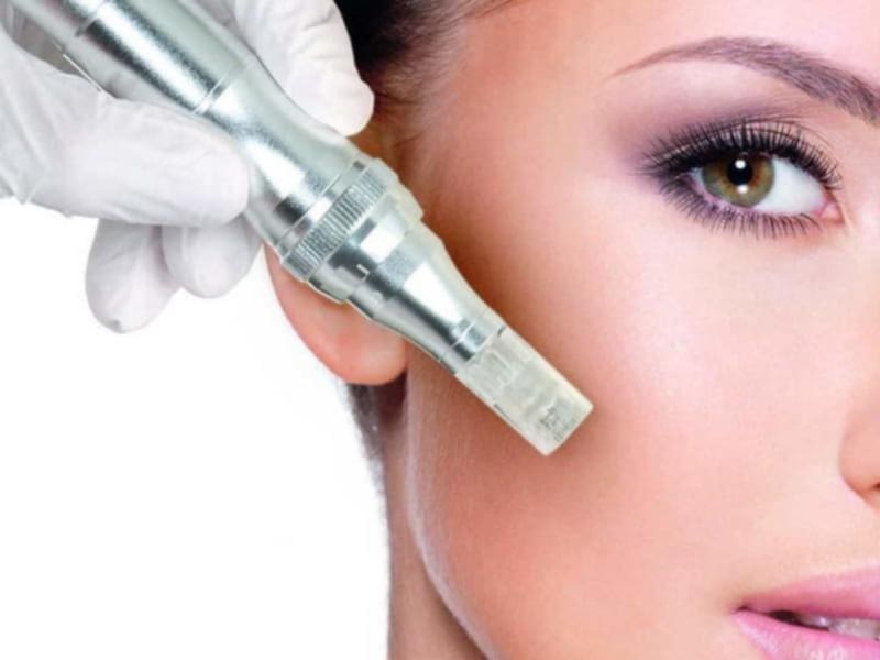 <strong>Micro-Needling</strong>